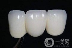 貴金屬烤瓷牙的危害有哪些？