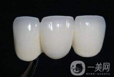 貴金屬烤瓷牙的危害有哪些？