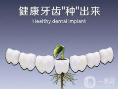 昆山種植牙多少錢 費用詳情一覽