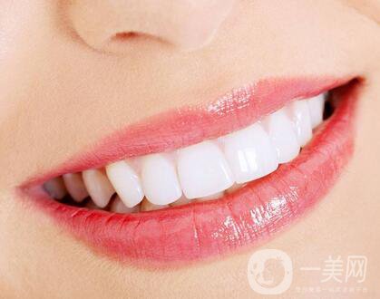 上海種植牙哪里*好？