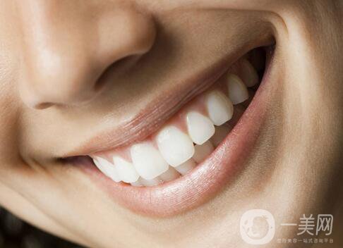 湖州種植牙多少錢一顆？