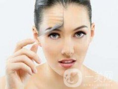 抬頭紋太重怎么辦？如何去抬頭紋？