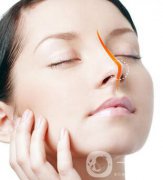 硅膠墊鼻梁多久生包膜？如何避免隆鼻后遺癥？