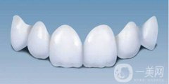 貴金屬烤瓷牙的種類(lèi)有哪些 分別有那些優(yōu)點(diǎn)