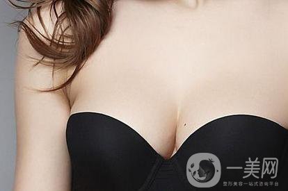 做完乳暈飄紅之后需要多久恢復(fù)正常？