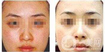 大s黑臉娃娃好嗎?大S嫩白肌膚的方法