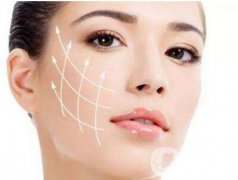 小切口面部提升手術(shù)抗衰果怎樣？