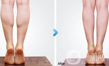 南京注射**多少錢