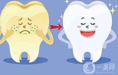 *潔牙,多少錢(qián)