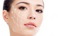 *除皺*嗎？可以維持多久的時間？