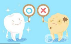 登騰做種植牙多少錢 價格影響因素詳解