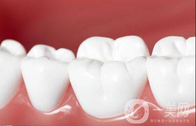 登騰做種植牙多少錢 價格影響因素詳解