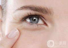 怎么除魚尾紋？有哪些方法？