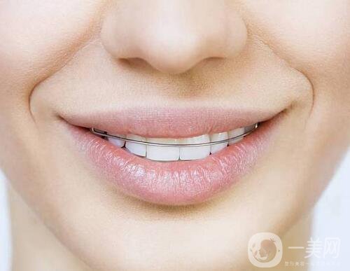 t4a可以矯正牙齒嗎？