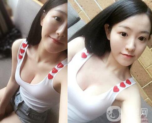 假體隆胸有什么危害？