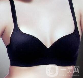 副乳切除術(shù)創(chuàng)口多大？