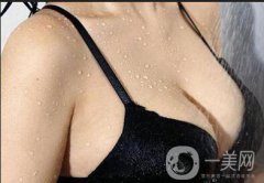 假體隆胸手術做完之后恢復期要多久時間？