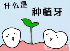 上海九院做一次種植牙價格是多少？價格貴嗎？