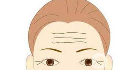 去除抬頭紋,方法