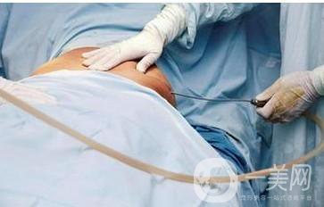 西安抽脂減肥價格 怎樣擁有好身材