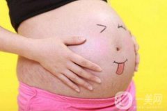 有妊娠紋怎么辦？什么方法**？