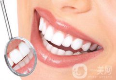 *潔牙多少錢一次？