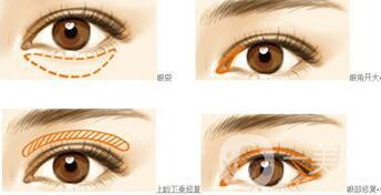 *都包含哪些項目？*整形多少錢