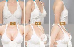 自體隆胸后多久可以上班？術(shù)后有哪些注意事項