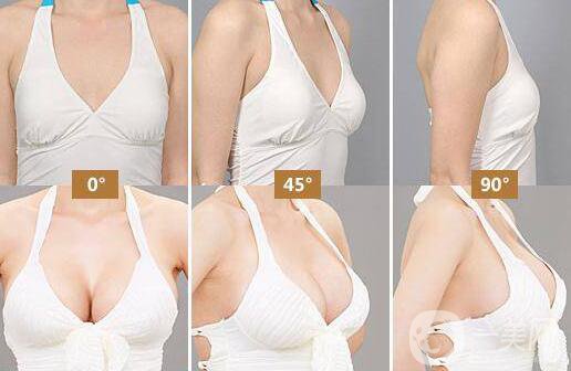 隆胸取出醫(yī)院介紹？隆胸取出后應該要注意什么