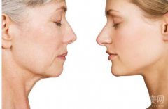 什么是小切口拉皮除皺術(shù)？適用人群有哪些？