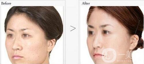 廣州做一次黑臉娃娃多少錢 價(jià)格表一覽