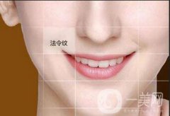 臉上長法令紋怎么才能祛除 方法介紹