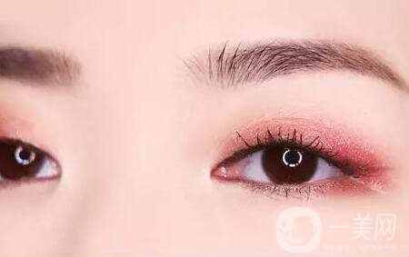 全切雙眼皮肉條多久消？