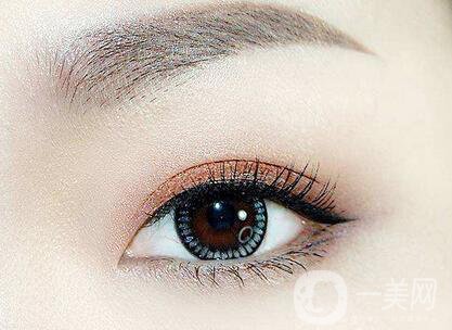 全切雙眼皮肉條多久消？