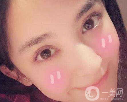 做了雙眼皮增生怎么辦？