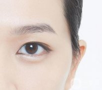 什么人適合開眼角？開眼角適宜人群有哪些？