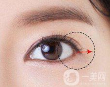 開眼角需要注意些什么？