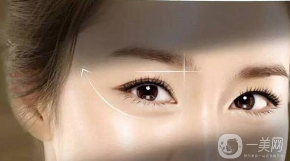 開眼角,風(fēng)險