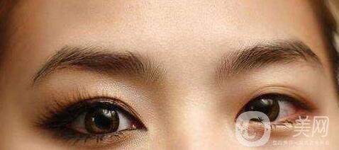 開眼角,風(fēng)險