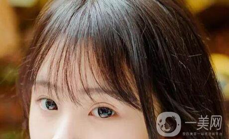 開眼角幾天可以拆線？術(shù)后注意事項盤點！