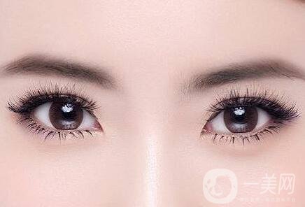 埋線雙眼皮術(shù)后護(hù)理有哪些？