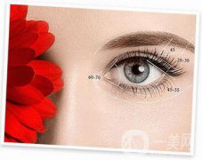 眼部手術(shù)整形主要都包含哪些項目