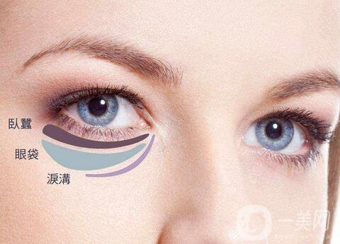 內(nèi)切眼袋真實(shí)恢復(fù)過(guò)程，術(shù)后注意事項(xiàng)