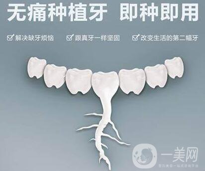 上海,全口種植牙,價(jià)格