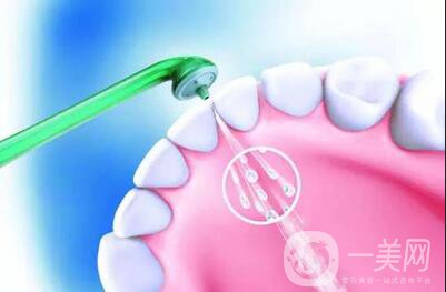 超聲波潔牙*果 注意事項(xiàng)主要有哪些