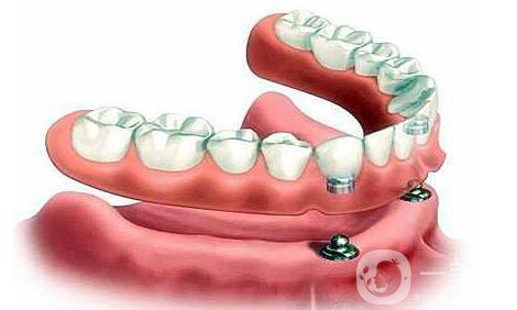 上海,種植牙醫(yī)院,信息介紹呢