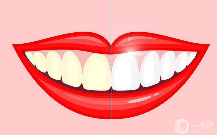 貴金屬烤瓷牙,危害