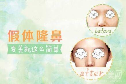 硅膠隆鼻可以維持一生嗎？