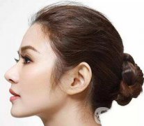 隆鼻能保持一輩子嗎？