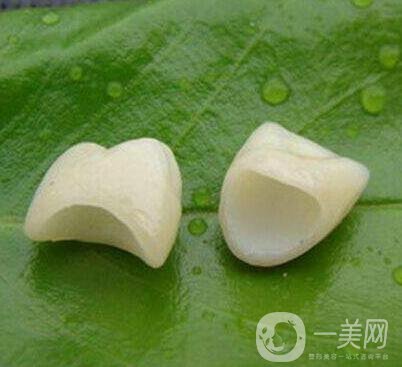 金鈀合金烤瓷牙價(jià)格多少錢？